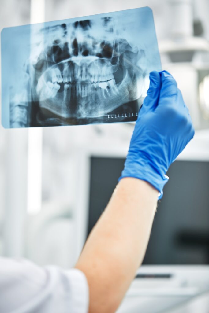 fogászati képalkotó diagnosztika2